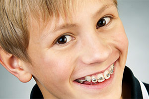 braces for kids
