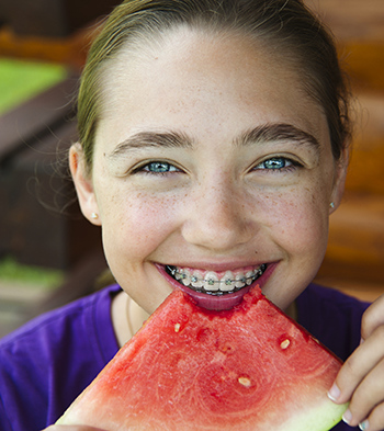 living with braces children kids watermelon
