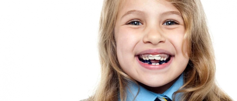 Common orthodontic problems in children